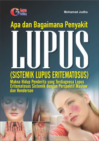 Image of Apa dan Bagaimana Penyakit LUPUS (Sistemik Lupus Eritematosus )