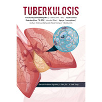 Image of Tuberkulosis